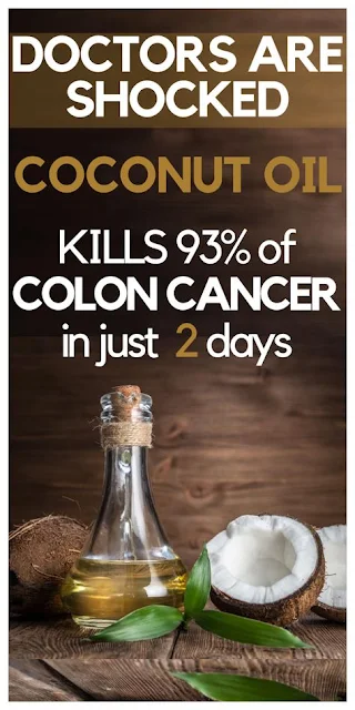 DOCTORS ARE SHOCKED: This Kills 93% Of Colon Cancer In Only 2 Days!