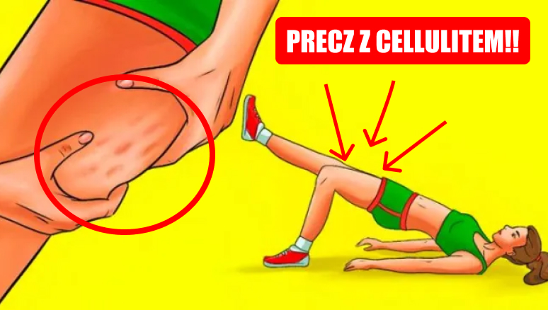 Cellulit - 5 prostych ćwiczeń na pozbycie się z ud czy pośladków