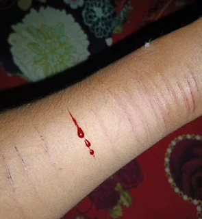 ব্লেড দিয়ে হাত কাটা পিক মেয়েদের