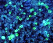 <img src="fluorescencia-ebstein-barr-virus.jpg" width ="148" height "180" border ="0" alt ="Células infectadas con virus Epstein Barr">