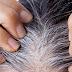 टेंशन और तनाव की वजह से भी कम उम्र में सफेद हो सकते हैं बाल