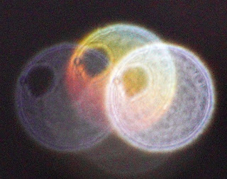 breast-like pattern in orb