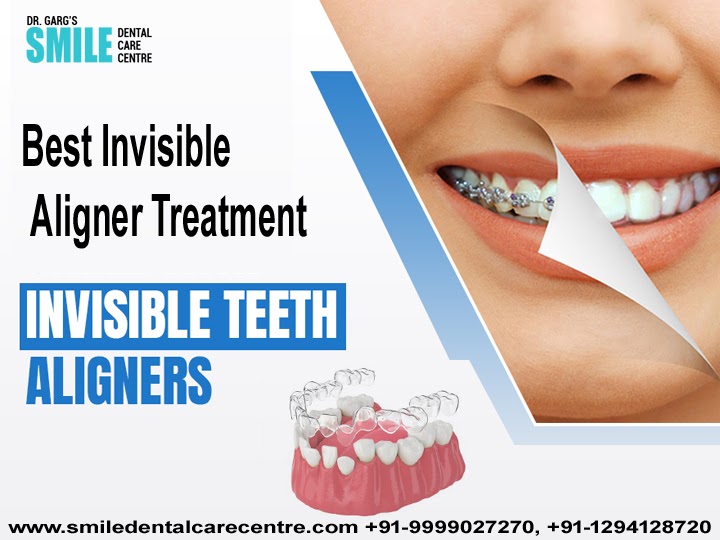 Most Useful Information About Oral Treatments Posted By Best Dental Clinic in Faridabad
