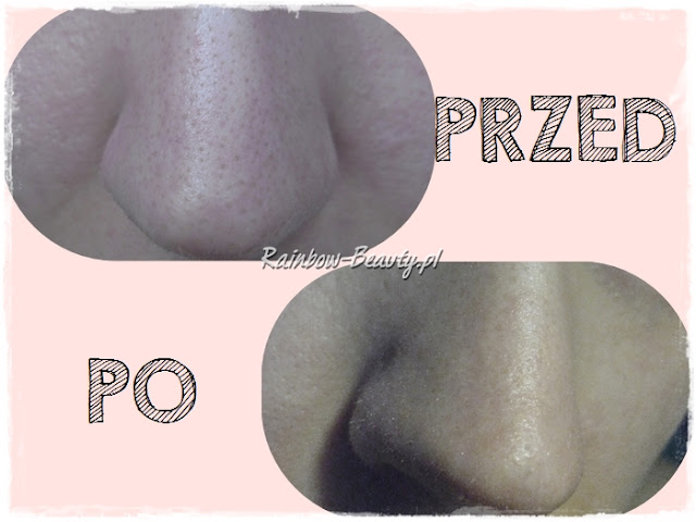 holika-holika-pig-nose-plastry-nos-opinie-blog-efekty-dzialanie-zaskorniki