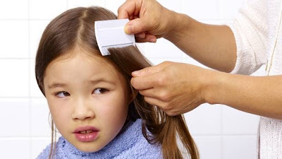 6 Cara Alami Menghilangkan  Kutu  Di Rambut  BlogDokter