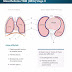 Mesothelioma Treatment Options By Stage