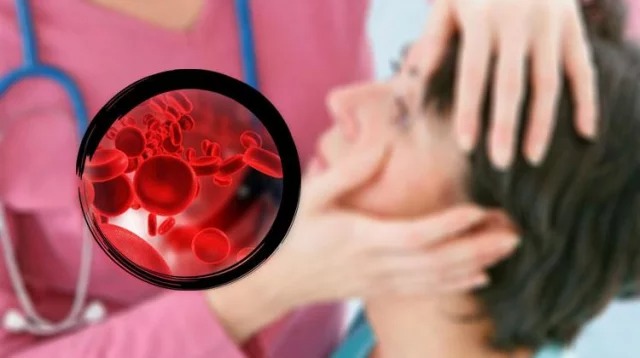 Anemia Anemia can be a serious disease, Anemia - Symptoms and Causes, Anemia: Is it dangerous and how to treat it