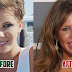 Celebrity plastic surgery fails before and after