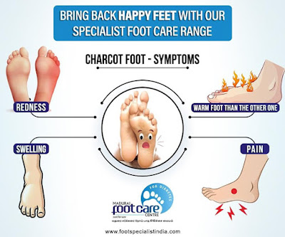 Charcot Foot