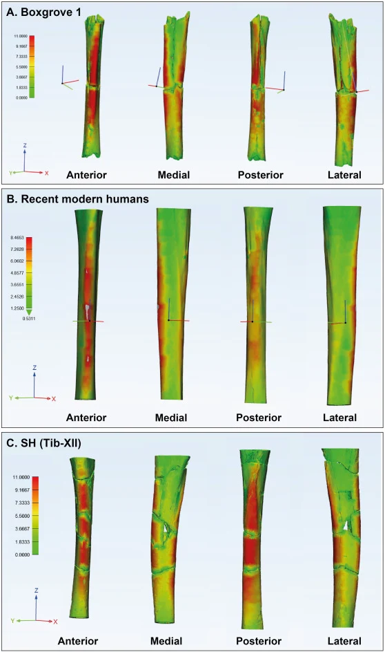 comparison of tibial bone thickness