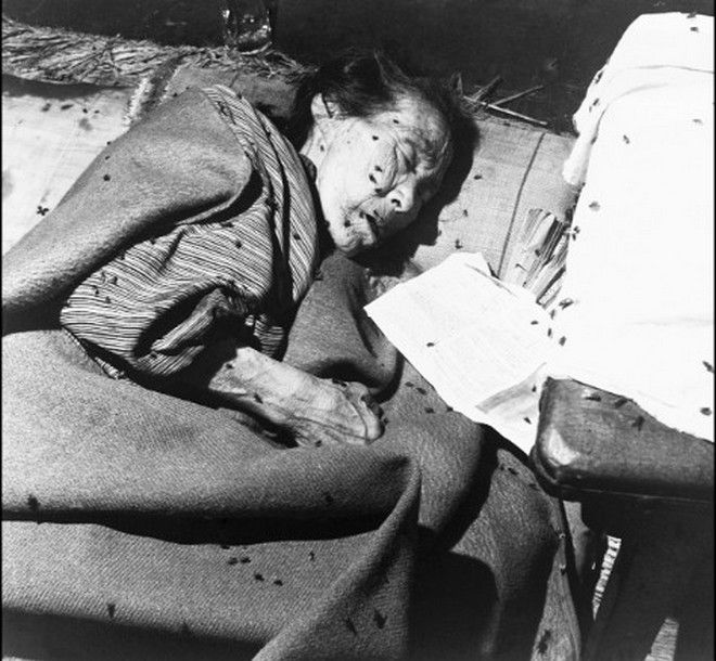 20 Shocking Pictures Of Hiroshima, The First City In History To Be Destroyed By An Atomic Bomb - An elderly woman in a makeshift hospital in Hiroshima after the destruction.
