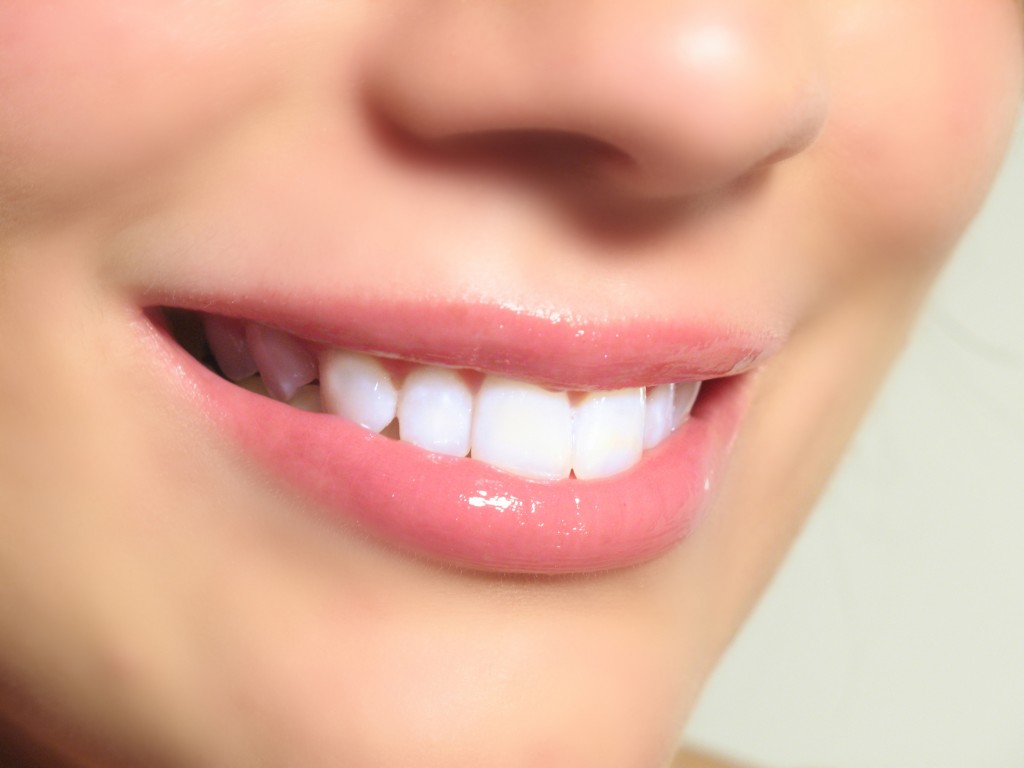 Over the counter teeth whitening products