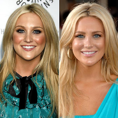 heidi montag before and after. After coming clean to Us