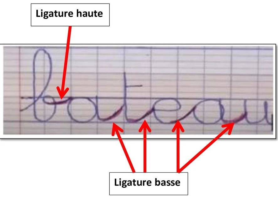 Les ligatures……Qu’est-ce qu’une ligature ?