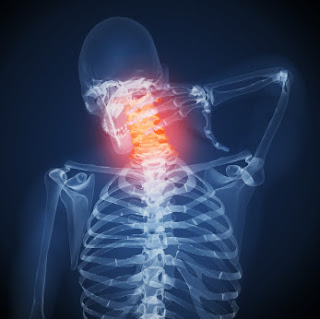 MEASURES TO RELIEVE NECK PAIN