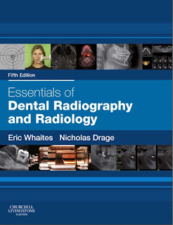 Essentials of Dental Radiography and Radiology by Churchill Livingstone PDF