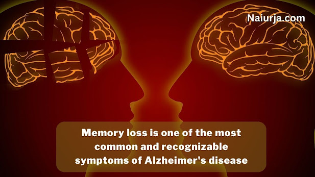 Know what is Alzheimer's and its 10 early symptoms, and keep your family safe.