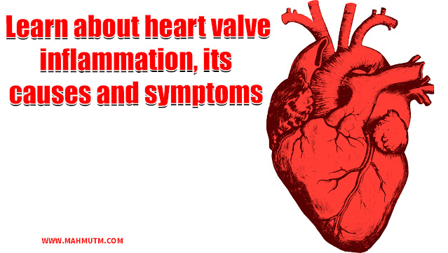 Learn about heart valve inflammation, its causes and symptoms