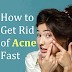 How to Get Rid of Acne Fast