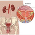 Prostatite crónica infecção bexiga - Prostatite sintomas e prostatite cronica tratamento.