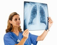 How to get lung cancer without smoking