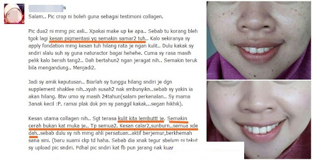 cara atasi masalah jeragat tebal di muka dengan selamat