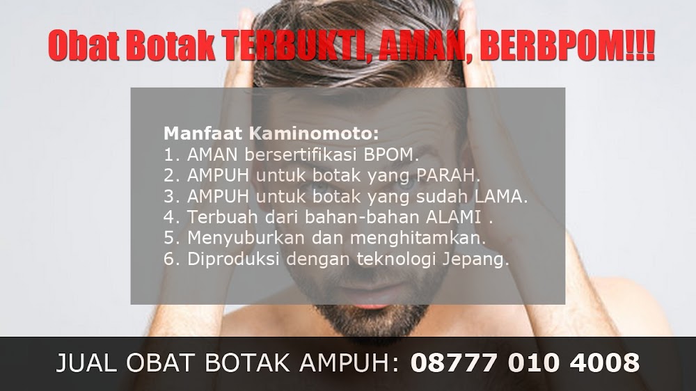 CARA MENUMBUHKAN RAMBUT AGAR CEPAT PANJANG<br/>Manggarai Barat<br/>