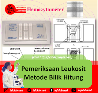 pemeriksaan leukosit,pemeriksaan leukosit manual,pemeriksaan leukosit metode tabung,pemeriksaan leukosit pada feses,pemeriksaan leukosit pdf,pemeriksaan leukosit untuk apa,pemeriksaan leukosit secara manual,pemeriksaan leukosit dengan kamar hitung,pemeriksaan leukosit esterase,pemeriksaan leukosit urin,pemeriksaan leukosit pada urin,pemeriksaan leukosit metode pipet thoma,pemeriksaan leukosit untuk,pemeriksaan leukosit normal,pemeriksaan leukosit cara tabung,pemeriksaan leukosit metode bilik hitung,pemeriksaan leukositosis,pemeriksaan leukosit metode pipet,pemeriksaan leukosit pada typhoid,laporan pemeriksaan leukosit,cara pemeriksaan leukosit,pemeriksaan leukosit adalah,pemeriksaan antal leukosit,pemeriksaan antal leukosit metode tabung,laporan pemeriksaan antal leukosit,jurnal pemeriksaan antal leukosit,prinsip pemeriksaan antal leukosit,dasar teori pemeriksaan antal leukosit,alat pemeriksaan leukosit,laporan resmi pemeriksaan antal leukosit,arti pemeriksaan leukosit,pemeriksaan leukosit bilik hitung,cara pemeriksaan leukosit manual,cara pemeriksaan leukosit secara manual,cara pemeriksaan leukosit esterase,cara pemeriksaan leukosit darah,cara pemeriksaan leukosit metode tabung,pemeriksaan hitung jumlah leukosit cara tabung,pemeriksaan leukosit darah,pemeriksaan leukosit dalam urine,pemeriksaan diferensial leukosit,prosedur pemeriksaan leukosit dengan kamar hitung,pemeriksaan eritrosit dan leukosit,laporan pemeriksaan leukosit dan eritrosit,leukosit dalam pemeriksaan lab,pemeriksaan trombosit dan leukosit,fungsi pemeriksaan leukosit,guna pemeriksaan leukosit,pemeriksaan hitung leukosit,pemeriksaan hematologi leukosit,pemeriksaan hitung leukosit pdf,laporan pemeriksaan hitung leukosit,prinsip pemeriksaan hitung leukosit,prosedur pemeriksaan hitung leukosit,pembahasan pemeriksaan hitung leukosit,hasil pemeriksaan leukosit,laporan praktikum pemeriksaan hitung leukosit,hasil pemeriksaan leukosit tinggi,tujuan pemeriksaan hitung leukosit,pemeriksaan leukosit pada ibu hamil,sop pemeriksaan hitung leukosit,jurnal pemeriksaan hitung leukosit,indikasi pemeriksaan leukosit,interpretasi pemeriksaan leukosit,tujuan pemeriksaan leukosit pada ibu hamil,pemeriksaan jumlah leukosit,pemeriksaan jenis leukosit,pemeriksaan jumlah leukosit pdf,pemeriksaan hitung jumlah leukosit pdf,pemeriksaan hitung jenis leukosit pdf,laporan pemeriksaan jumlah leukosit,pemeriksaan hitung jumlah leukosit metode tabung,laporan pemeriksaan jenis leukosit,jurnal pemeriksaan jumlah leukosit,prinsip pemeriksaan jumlah leukosit,tujuan pemeriksaan jumlah leukosit,cara pemeriksaan jumlah leukosit,makalah pemeriksaan jumlah leukosit,metode pemeriksaan jumlah leukosit,jurnal pemeriksaan leukosit,jurnal pemeriksaan leukosit pdf,cara kerja pemeriksaan jumlah leukosit,pemeriksaan kelainan leukosit,kegunaan pemeriksaan leukosit,kesimpulan pemeriksaan leukosit,pemeriksaan lab leukosit,langkah pemeriksaan leukosit,laporan pemeriksaan leukosit metode pipet thoma,sop pemeriksaan leukosit manual,cara kerja pemeriksaan leukosit metode tabung,metode pemeriksaan leukosit,makalah pemeriksaan leukosit,manfaat pemeriksaan leukosit,modifikasi pemeriksaan leukosit,pembahasan pemeriksaan leukosit metode tabung,materi pemeriksaan leukosit,metode pemeriksaan leukosit pdf,prosedur pemeriksaan leukosit,prinsip pemeriksaan leukosit,pengertian pemeriksaan leukosit,hasil pemeriksaan urine leukosit positif,pembahasan pemeriksaan leukosit,rumus pemeriksaan leukosit,pemeriksaan sel leukosit,pemeriksaan sedimen leukosit,pemeriksaan hitung sel leukosit,pemeriksaan jumlah sel leukosit,sop pemeriksaan leukosit,satuan pemeriksaan leukosit,pemeriksaan hitung jumlah sel leukosit,prosedur pemeriksaan sel leukosit,pemeriksaan leukosit turk,tujuan pemeriksaan leukosit,pemeriksaan leukosit untuk penyakit apa,pemeriksaan urine leukosit