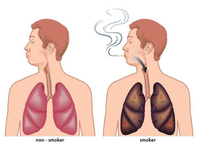 طرق بسيطة وسهلة لـتنظيف الرئتين للأشخاص المدخنين