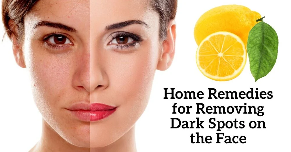 8 Home Remedies for Removing Dark Spots on the Face Using Lemon Juice