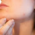  Acne Treatment Recommended By Dermatologists