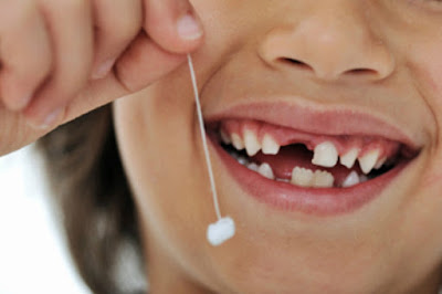 Cách nhổ răng sữa không đau tại nhà cho bé
