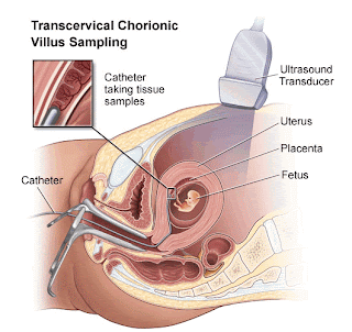 Pregnancy- picture