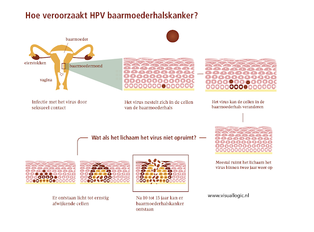 Infographic HPV