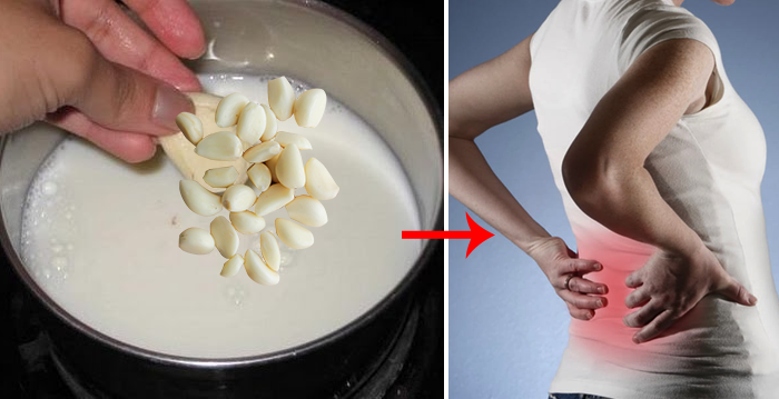 Garlic Milk Is An Excellent Homemade Remedy Against Sciatica And Back Pain