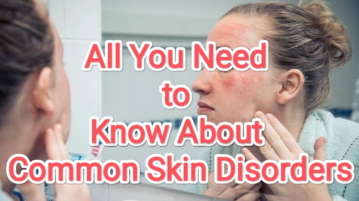 All You Need To Know About Common Skin Disorders Symptoms And