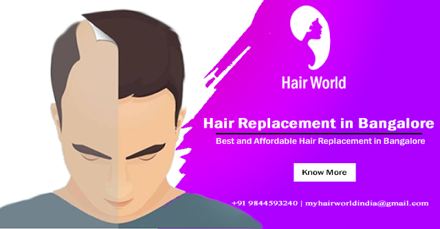 Hair replacement in Bangalore