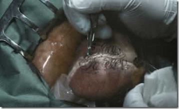 tato jantung