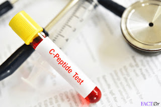 Diabetes C-peptide test