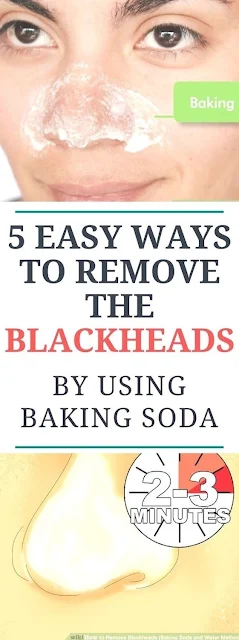 5 Easy Ways to Remove Blackheads With Baking Soda