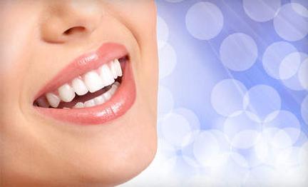 best-teeth-whitening-kits