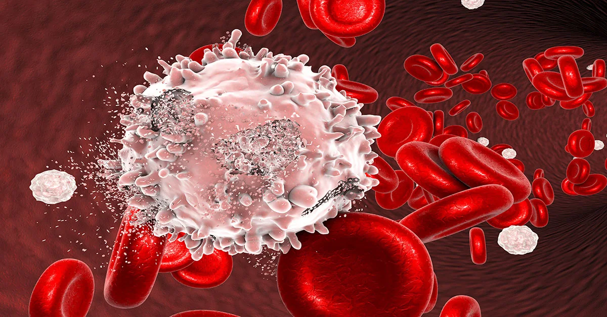 سرطان الدم leukemia