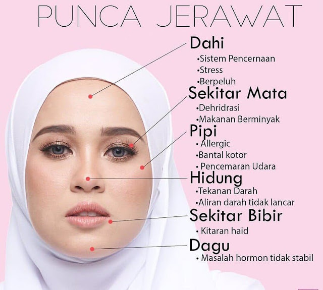 Jerawat