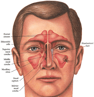 Sinus Infection Photos