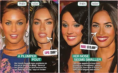 megan fox plastic surgery