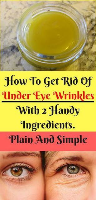 How To Get Rid Of Under Eye Wrinkles With 2 Handy Ingredients. Plain And Simple
