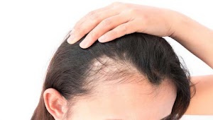 Natural Herbs For Hair growth and Thickness