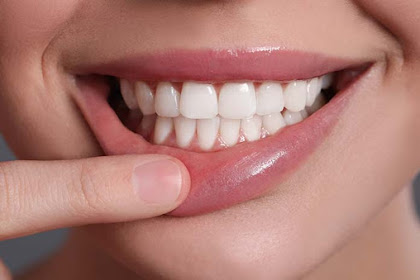 Manfaat dan Cara Menjaga Kesehatan Gigi dan Mulut