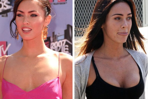 megan fox before after surgery. Megan Fox before and after