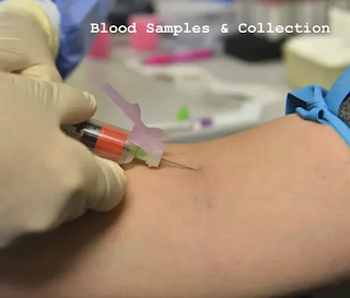 Blood Samples & Blood Collection Tubes